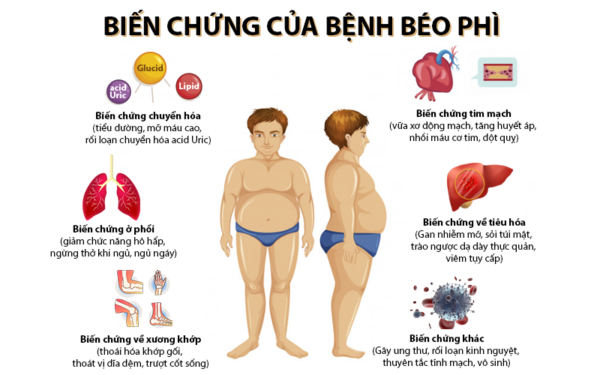 Gia công Kem tan mỡ sinh học - Đánh tan mỡ thừa 8 tác hại thừa cân béo phì