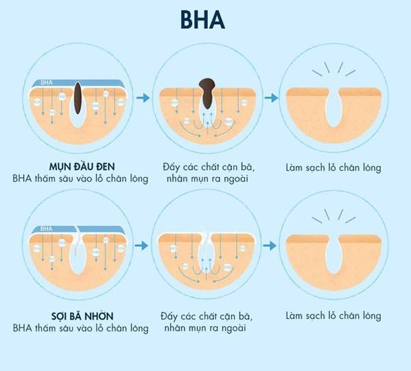 Gia công Peel BHA chiết xuất Lộc Đề 10 trị mụn bha