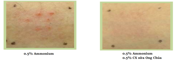 Gia công Toner dưỡng ẩm cân bằng da 8 giảm kích ứng mẩn đỏ sữa ong chúa