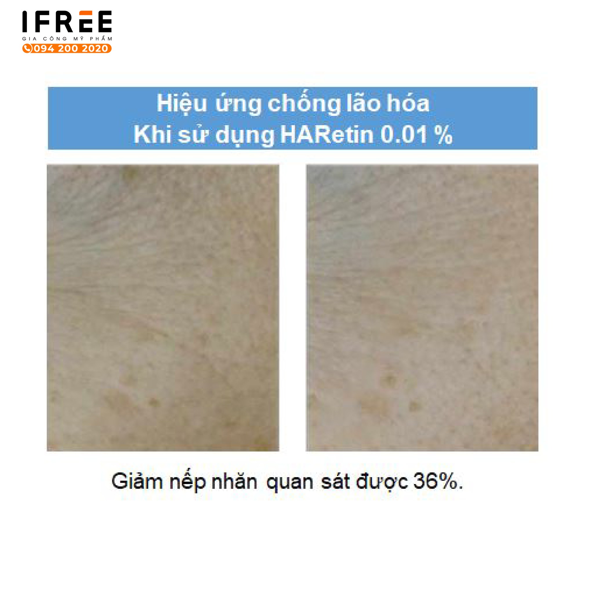 Gia công kem trị nám căng bóng da 4 Gia công kem trị nám căng bóng da