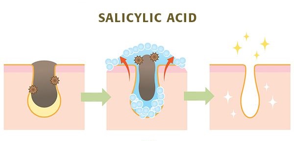 Gia công Kem mụn tràm trà 20 công dụng Salicylic Acid