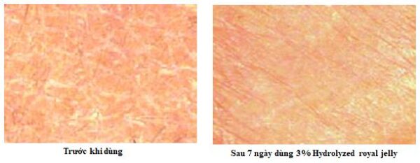 Gia công Serum tảo đỏ dưỡng trắng căng bóng 12 tác dụng trước sau sữa ong chúa