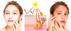 Gia công Sữa chống nắng SPF50 mỏng nhẹ, PA++++ 2 tác hại tia uva, uvb